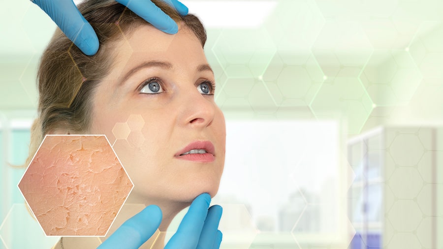 تشخیص بیماری های پوستی توسط هوش مصنوعی